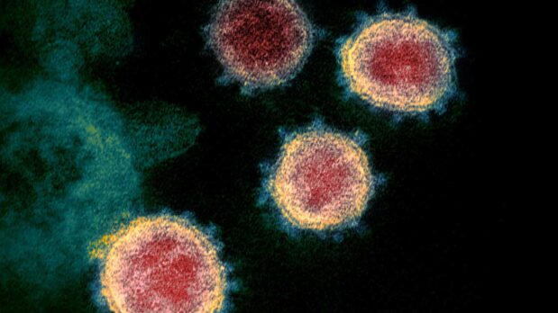 How the New York Times Lies about SARS-CoV-2 Transmission: Part 1 43 An electron microscope image of SARS-CoV-2 isolated from a patient in the US (Photo by NIAID, licensed under CC BY 2.0)
