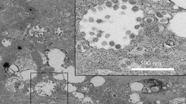 Correcting Misinformation about SARS-CoV-2 Whole Genome Sequencing 7 An electron microscopy image of SARS-CoV-2 from a study published in Nature in February 2020.